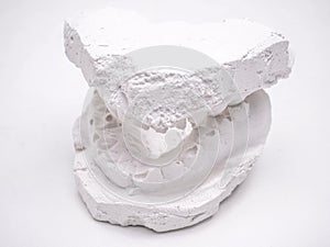 Whole jaw gypsum impression