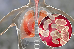 Whooping cough bacteria in human airways