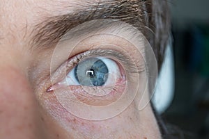 Wide open Caucasian male eye. Close up shot portrait, unrecognizable face