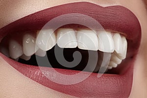 Wide smile of young beautiful woman, perfect healthy white teeth. Dental whitening, ortodont, care tooth and wellness