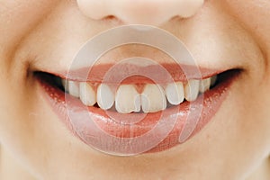 Wide smile of young fresh woman with great healthy white teeth. Closeup of woman smiling with prefect white teeth