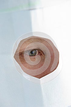 Window in a mask for treatment of an eye
