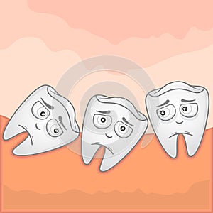 Wisdom tooth - Illustration