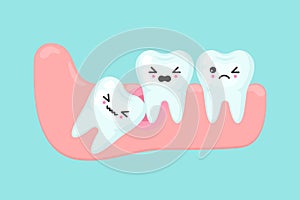 Wisdom tooth problems dental stomatology vector concept