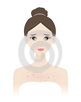 The woman with acne on chest vector illustration isolated on white background.