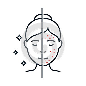 Woman with Acne and Clean Face Skin Line Icon. Female Skincare for Cleansing Face and Problem Skin Outline Icon. Girl