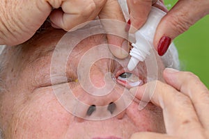 Woman administering eyedrops to an elderly man