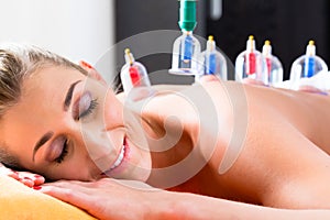 Woman in alternative medical cupping therapy