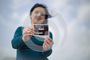 Single Woman announced pregnancy outdoors photo