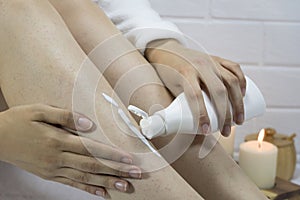 A woman applies a moisturizer to the skin of her legs. Problem skin, strawberry legs, chicken skin, hyperkeratosis, keratosis photo