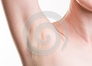 Woman armpit after shaving hair. Skinny girl with hair depilation on white background. Cosmetic procedures. Beauty salon. Macro cl