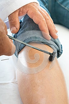 Woman being treated with acupuncture hammer