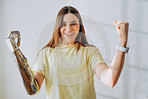 Woman with bionic prosthesis arm shows winner gesture