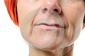 Woman with blemish on chin photo