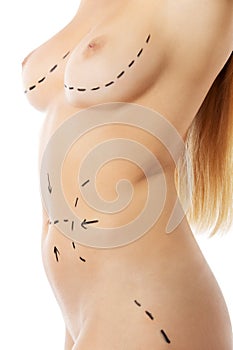 Woman body marked out for cosmetic surgery.