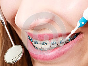 Woman with braces having dentist appointment