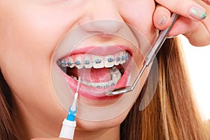 Woman with braces having dentist appointment