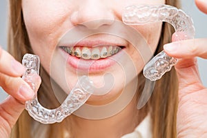 Woman with braces on her teeth holding and removable transparent aligners.