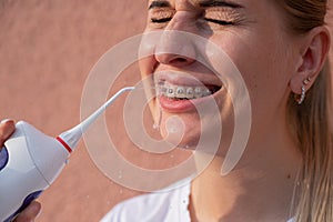A woman with braces on her teeth uses an irrigator. Close-up portrait.