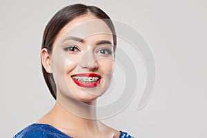 Woman with braces on white teeth. Beautiful woman in braces smiling on white background