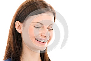 Woman with brackets on teeth photo