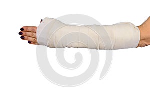 Woman broken arm bone in cast, plastered hand on white isolated background.