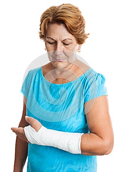 Woman with a broken arm on a plaster cast