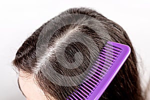 The woman is a brunette, parting her hair with a comb and showing the results of treatment for dandruff. Close up. White