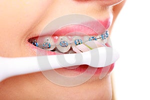 Woman brushing teeth with braces using brush