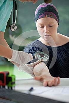 Woman with cancer during mole examining