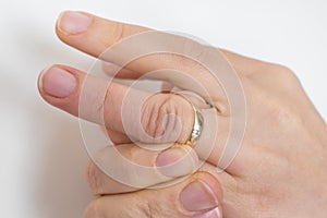 Woman cannot take off stuck wedding ring photo