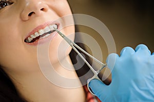 Woman with ceramic braces on teeth at the dental office