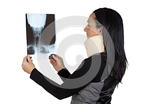 Woman with cervical collar and radiography