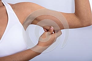 Woman Checking Excessive Fat On Her Arms
