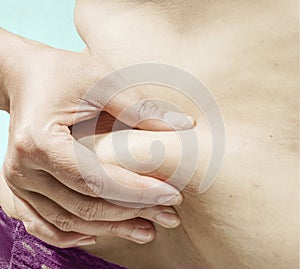 Woman Checking Fat On Her Abdomen