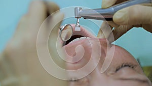 Woman cleaning teeth at the dentist. Dentist brushing teeth. Teeth whitening. Extreme shot of female teeth polishing