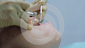 Woman cleaning teeth at the dentist. Dentist brushing teeth. Teeth whitening. Extreme shot of female teeth polishing