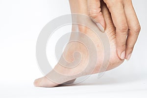 Woman cracked heels with white background, Foot healthy