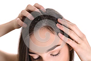 Woman with dandruff in her hair on background, closeup photo