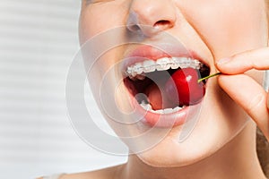 Woman with dental brackets biting off red cherry photo