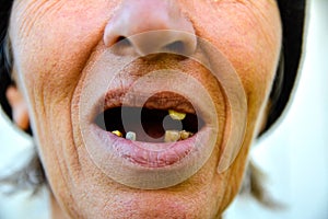 Woman with dental problems