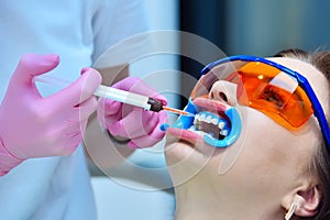 Woman dentist applies gel to teeth before teeth whitening procedure