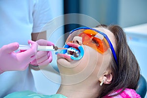 Woman dentist applies whitening gel to patient`s teeth