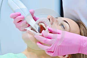 Woman dentist using dental intraoral scanner