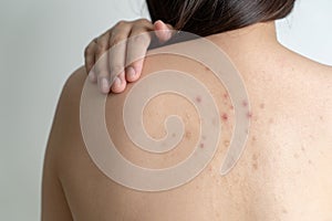 Žena dermatologie kůže zkoumání 