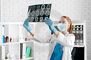 Woman doctor examines head mri scan in hospital