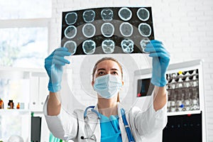 Woman doctor examines head mri scan in hospital