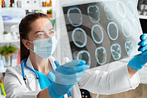 Woman doctor examines head mri scan in hospital