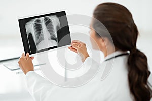 Woman doctor hands holding patient chest x-ray film