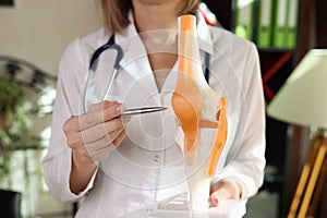 Woman doctor holds anatomical model of human knee-joint and points by pen.